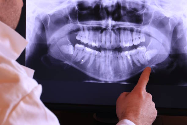 Best Emergency Tooth Extraction in Calvert, TX