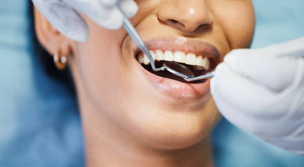 Best Emergency Tooth Extraction in Calvert, TX