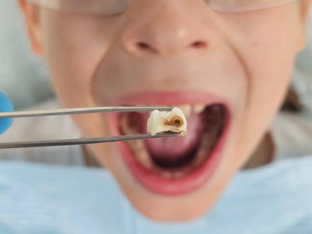 Best Same-Day Emergency Dentist in Calvert, TX